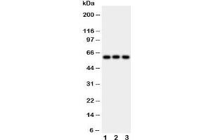 Western blot testing of HEXA antibody and Lane 1:  rat liver;  2: human HeLa;  3: (h) SMMC-7721 cell lysate.