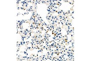 Immunohistochemistry of paraffin embedded mouse pneumonia using CCL3 (ABIN7073450) at dilution of 1:1000 (400x lens)