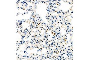 Immunohistochemistry of paraffin embedded mouse pneumonia using CCL3 (ABIN7073450) at dilution of 1:1000 (400x lens) (CCL3 anticorps)