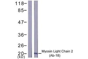 Western blot analysis of extract from K562 cells, using Myosin Light Chain 2 (Ab-18) antibody (E021157). (Myosin anticorps)