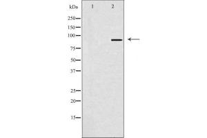 Western blot analysis of SOX6 Antibody expression in Hela cells lysates. (SOX6 anticorps  (N-Term))
