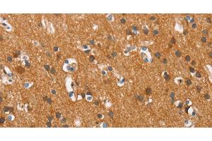 Immunohistochemistry of paraffin-embedded Human brain tissue using COX5A Polyclonal Antibody at dilution 1:40 (COX5A anticorps)