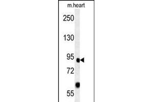 FOXP2 Antibody (C-term) (ABIN651939 and ABIN2840465) western blot analysis in mouse heart tissue lysates (15 μg/lane). (FOXP2 anticorps  (AA 657-684))