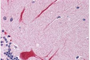 Human Brain, Cerebellum: Formalin-Fixed, Paraffin-Embedded (FFPE) (PTPN11 anticorps  (AA 584-597))