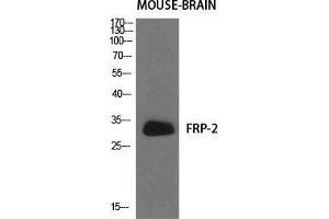 Western Blot (WB) analysis of specific cells using FRP-2 Polyclonal Antibody.