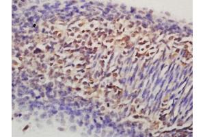 Formalin-fixed and paraffin embedded rat embryo labeled with Rabbit Anti-Nanog Polyclonal Antibodyy, Unconjugated (ABIN2177828) at 1:200 followed by conjugation to the secondary antibody and DAB staining