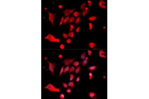 Immunofluorescence analysis of U2OS cells using MAD2L1 antibody (ABIN5970848). (MAD2L1 anticorps)