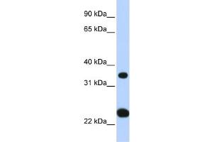 WB Suggested Anti-SLC25A35 Antibody Titration:  0. (SLC25A35 anticorps  (N-Term))