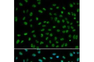 Immunofluorescence analysis of MCF-7 cells using DDB2 Polyclonal Antibody