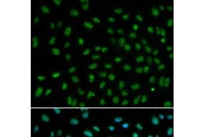 Immunofluorescence analysis of MCF-7 cells using DDB2 Polyclonal Antibody (DDB2 anticorps)