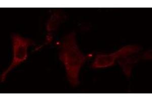 ABIN6278644 staining HuvEc cells by IF/ICC. (TMPRSS3 anticorps  (Internal Region))
