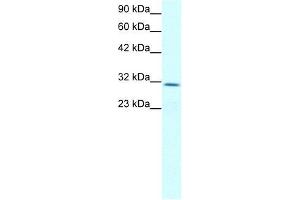 Human Jurkat; WB Suggested Anti-CLDN17 Antibody Titration: 2. (Claudin 17 anticorps  (Middle Region))