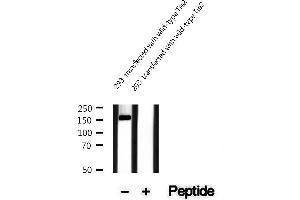 Western blot analysis of extracts of 293 cells transfected with wild-type Tie2, using Phospho-Tie2 (Tyr992) Antibody.