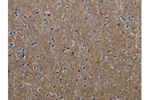 The image on the left is immunohistochemistry of paraffin-embedded Human brain tissue using ABIN7129632(GNG2 Antibody) at dilution 1/60, on the right is treated with fusion protein.