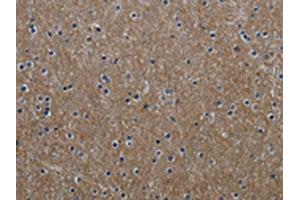 The image on the left is immunohistochemistry of paraffin-embedded Human brain tissue using ABIN7129632(GNG2 Antibody) at dilution 1/60, on the right is treated with fusion protein. (GNG2 anticorps)