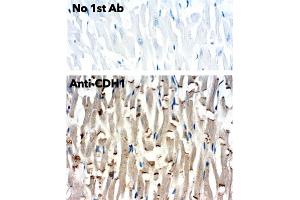 Immunohistochemistry (IHC) image for anti-Cadherin 1, Type 1, E-Cadherin (Epithelial) (CDH1) antibody (ABIN1440031)