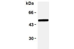 Western Blotting (WB) image for anti-Vimentin (VIM) antibody (ABIN1109484) (Vimentin anticorps)
