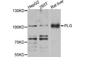 Western blot analysis of extracts of various cell lines, using PLG antibody (ABIN5971711) at 1/1000 dilution. (PLG anticorps)