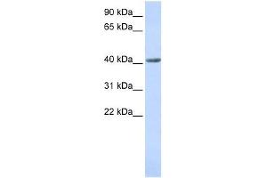 SMYD3 antibody used at 0. (SMYD3 anticorps  (N-Term))