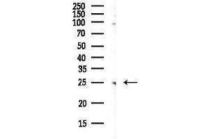 Western blot analysis of lysates from HepG2 cells(LPS, 4h treatment), using CHMP5 Antibody at 1/1000 dilution.