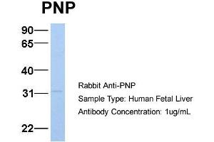 Host:  Rabbit  Target Name:  PNP  Sample Type:  Human Fetal Liver  Antibody Dilution:  1. (NP (Middle Region) anticorps)