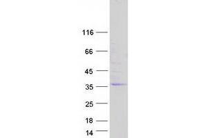 Validation with Western Blot