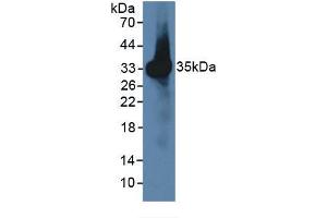 WB of Protein Standard: different control antibodies against Highly purified E.