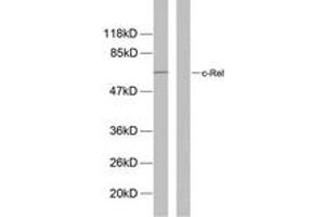 Western blot analysis of extracts from MDA-MB-435 cells, using Rel (Phospho-Ser503) Antibody. (c-Rel anticorps  (pSer503))
