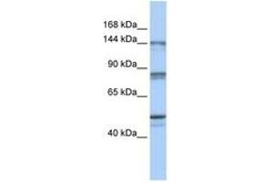 Image no. 1 for anti-CSE1 Chromosome Segregation 1-Like (CSE1L) (N-Term) antibody (ABIN6744330) (Exportin 2 anticorps  (N-Term))