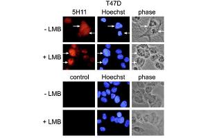 Immunofluorescence using anti-PARP-10 [ARTD10] (human), mAb (5H11). (PARP10 anticorps  (AA 1-907))