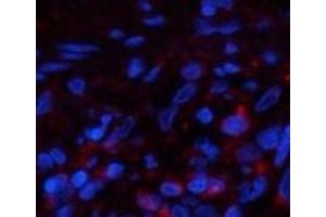 Immunofluorescence analysis of Human lung tissue using PPIB Monoclonal Antibody at dilution of 1:200. (PPIB anticorps)
