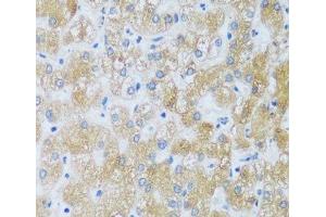 Immunohistochemistry of paraffin-embedded Human liver using ASB4 Polyclonal Antibody at dilution of 1:100 (40x lens). (ASB4 anticorps)