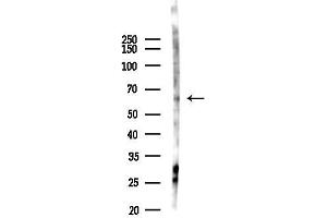 anti-Keratin 3 (KRT3) (C-Term) antibody