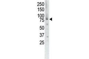 Western blot analysis of MUSK antibody and placenta cell lysate