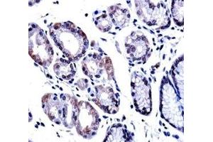 G3BP1 antibody immunohistochemistry analysis in formalin fixed and paraffin embedded human stomach tissue. (G3BP1 anticorps  (AA 401-430))