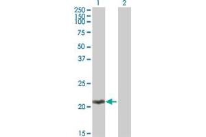 Western Blot analysis of MOBKL2C expression in transfected 293T cell line by MOBKL2C MaxPab polyclonal antibody. (MOBKL2C anticorps  (AA 1-216))