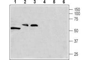 Western blot analysis of rat testis (lanes 1 and 4), rat brain (lanes 2 and 5) and mouse brain (lanes 3 and 6) lysates: - 1-3. (CACNG8 anticorps  (Intracellular, N-Term))