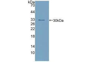 Western blot analysis of recombinant Human calretinin. (Calretinin anticorps  (AA 28-248))