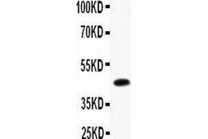 Western Blotting (WB) image for anti-B-cell antigen receptor complex-associated protein alpha chain (CD79A) (AA 121-226) antibody (ABIN3043397) (CD79a anticorps  (AA 121-226))