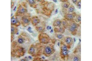 Used in DAB staining on fromalin fixed paraffin-embedded Liver tissue (MMP16 anticorps  (AA 351-557))