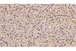 Detection of IDE in Mouse Cerebrum Tissue using Polyclonal Antibody to Insulin Degrading Enzyme (IDE)