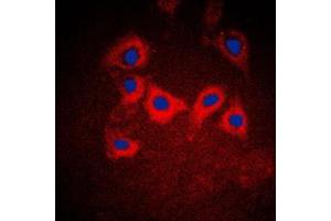 Immunofluorescent analysis of Cytokeratin 10 staining in A431 cells.