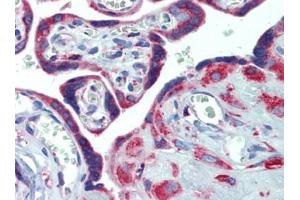 Placenta, Human: Formalin-Fixed, Paraffin-Embedded (FFPE) (PDIA4 anticorps  (AA 623-638))
