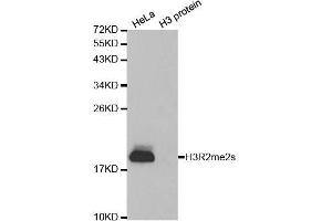 Western blot analysis of extracts of various cell lines, using Symmetric DiMethyl-Histone H3-R2 antibody. (Histone 3 anticorps  (H3R2me2))