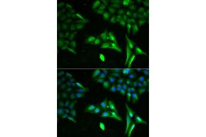 Immunofluorescence analysis of U20S cell using ACADS antibody. (ACADS anticorps)