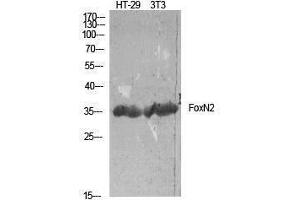 Western Blotting (WB) image for anti-Forkhead Box N2 (FOXN2) (C-Term) antibody (ABIN3184662)