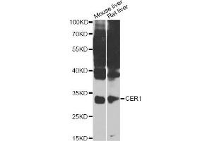Western blot analysis of extracts of various cell lines, using CER1 Antibody (ABIN4903254) at 1:1000 dilution. (CER1 anticorps)