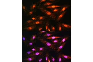 Immunofluorescence analysis of H9C2 cells using KIF Rabbit pAb (ABIN1680591, ABIN3019005, ABIN3019006 and ABIN6220670) at dilution of 1:100.