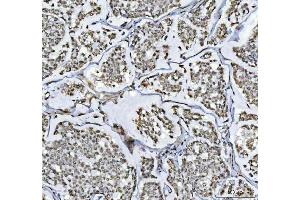 IHC analysis of RTCB using anti-RTCB antibody (ABIN7600722). (C22orf28 anticorps  (AA 227-505))