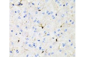 Immunohistochemistry of paraffin-embedded Mouse brain using ACVR2A Polyclonal Antibody at dilution of 1:100 (40x lens).